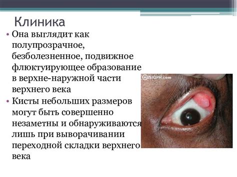 Безболезненное предупреждение