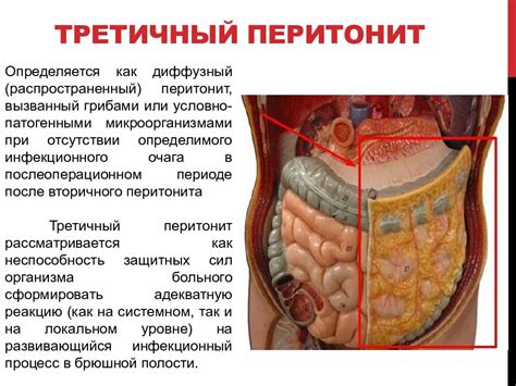 Возможные заболевания гуппи, приводящие к углу