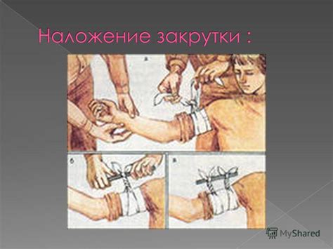Возможные причины выноса гемостатической губки из раны