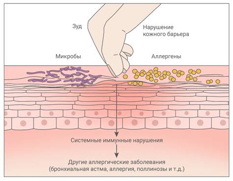 Зуд и раздражение на хвосте