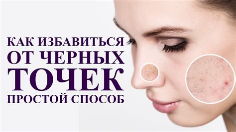 Как способ предотвращения черных точек