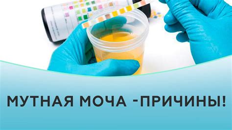 Моча с запахом сухариков с беконом: возможные причины