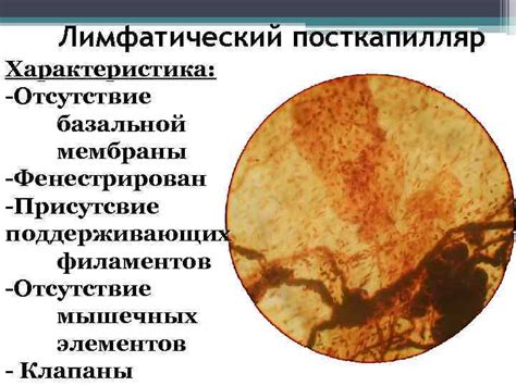 Отсутствие мышечных потрясений