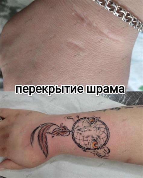 Причины исторического шрама