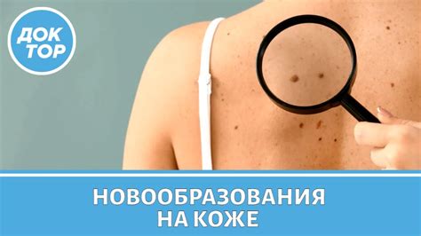 Узнайте основные факты о родинках на голове