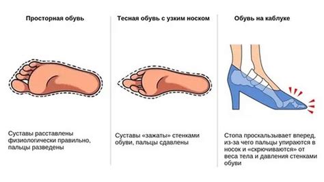 Влияние неправильной установки обратного клапана на функционирование двигателя