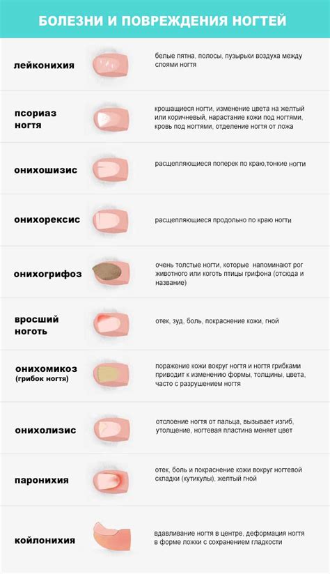 Избегайте давления на ногти при их сушке