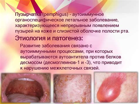 Причины формирования воздушных пузырей на гидрогелевой оболочке