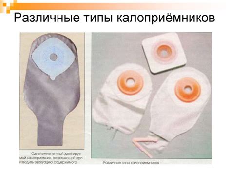 Проблемы, связанные с уходом за зоной интимной области