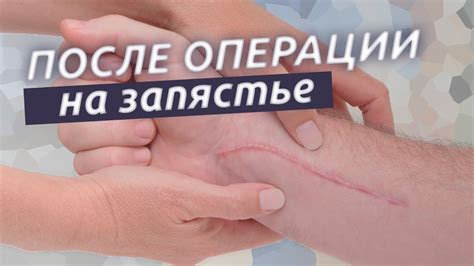Реабилитация после операции на органе слуха: советы от эксперта в сфере здоровья