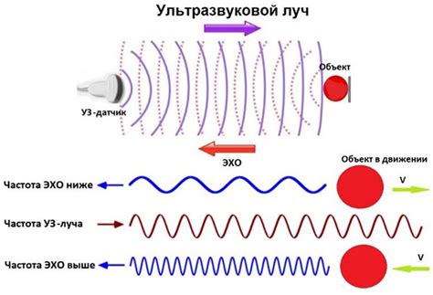  Принцип работы и характеристики ультразвука 