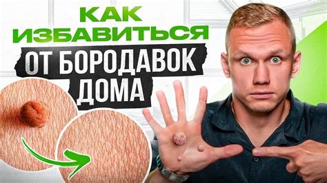 Избавляемся от непереносимых ухабов, используя zont