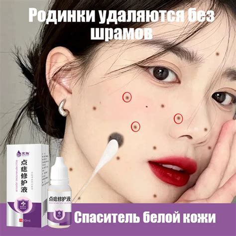 Лучшее время для удаления родинок на лице по лунному календарю
