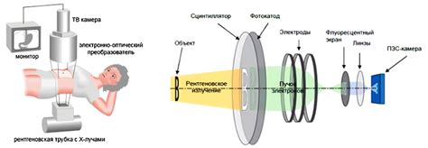 Процесс рентгеновского исследования