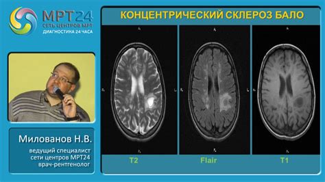 Влияние васкулярных изменений