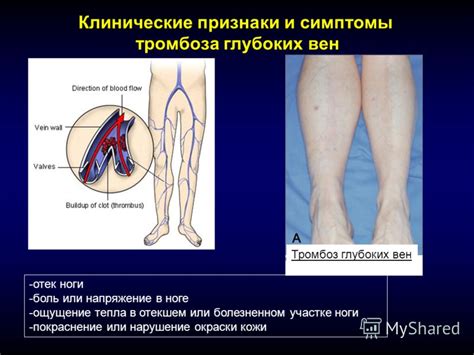 Диагностика приливов тепла в ноге