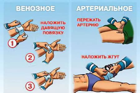 Наличие кровотечения или вагинального дискомфорта