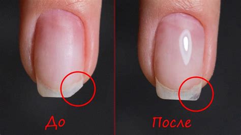  Как распознать сломанный нарощенный ноготь 