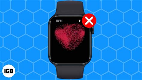 Активация ECG на смартфоне