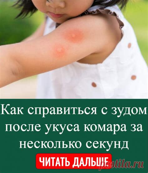 Важность следить за состоянием родинок после укуса комара