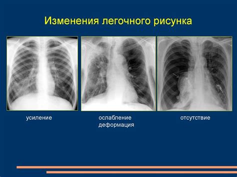 Влияние секундарных изменений на состояние легких