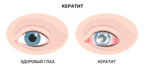 Возможные осложнения, если не обращать внимание на проблемы с глазами собаки