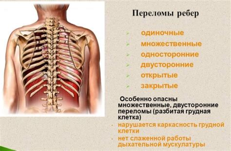 Возможные повреждения ребер при ударе в грудную область