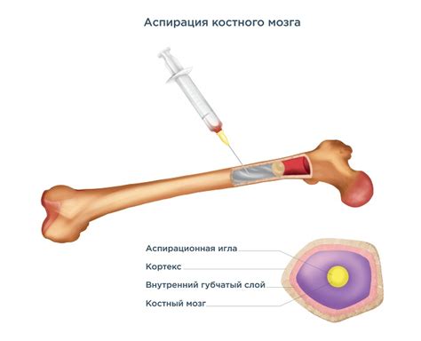 Восстановление костного мозга путем использования народных средств