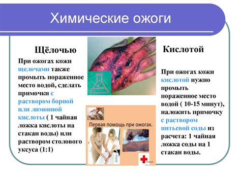 Временное обезболивание при легких повреждениях кожи