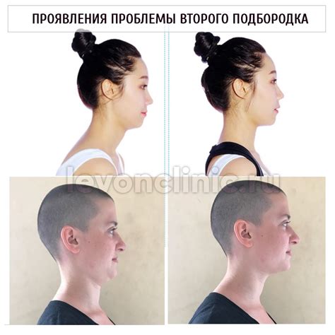 Второй подбородок и мужская привлекательность