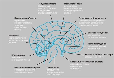 Где находятся супра и инфратенториальные структуры