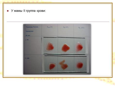 Генетические особенности цыганской крови