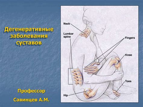 Дегенеративные заболевания суставов