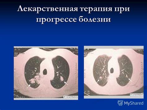 Диагностика пристеночного компонента