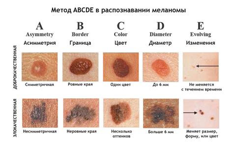 Диагностика слизи под кожей