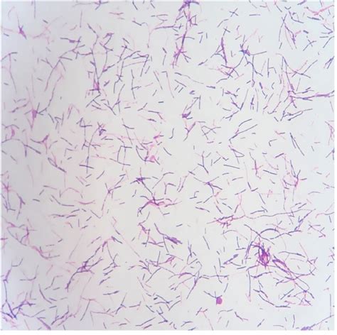 Дополнительные меры по профилактике Clostridium ramosum в крови