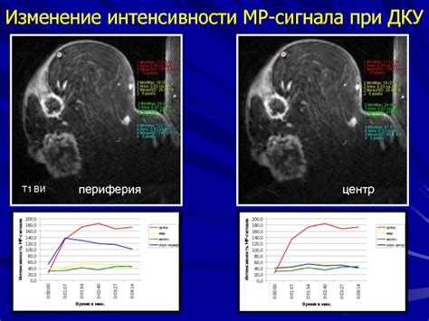 Значение МР-сигнала при диагностировании заболеваний