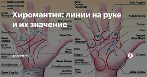 Значение иголки воткнутой в руку в соннике