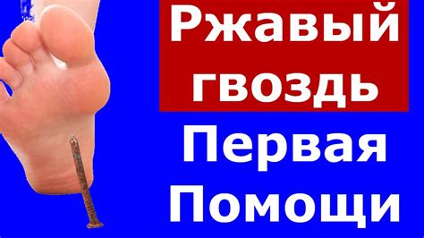 Значение сна: вытаскивать гвоздь из ноги