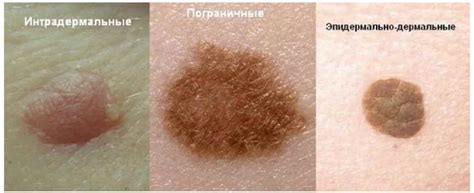 Как определить, какие украшения стоит удалить