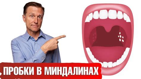 Локализация пробки