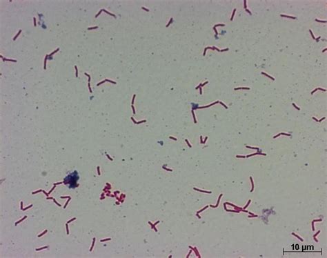 Основные способы лечения Clostridium ramosum в крови