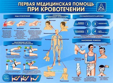 Первая помощь при кровотечении из уха