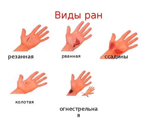 Повреждения кожи и мышц