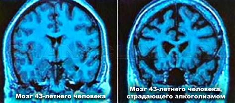 Повышение алкогольной крепости
