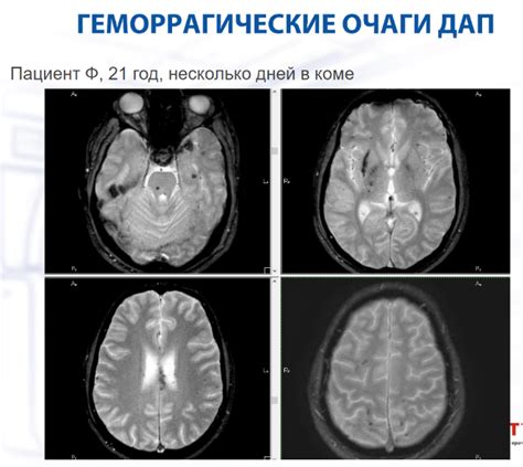 Понятие накопления Кв