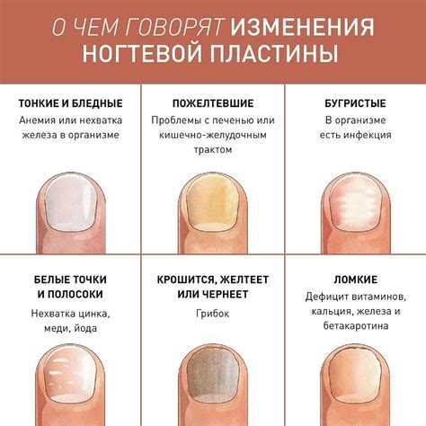 Последствия от перепиливания точки роста ногтя