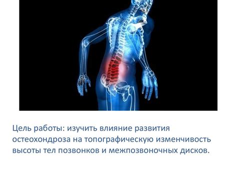 Практическое применение измерения высоты тел позвонков
