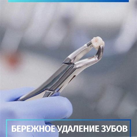 Преимущества удаления заявок быстро и безопасно