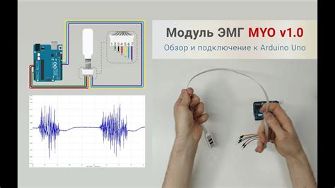 Принцип работы ЭМГ-датчика